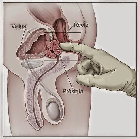 Dedo señalando la próstata